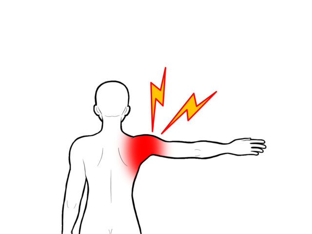 【五十肩・四十肩】肩の可動域が狭くなる前に新松戸の360°鍼灸整骨院で改善
