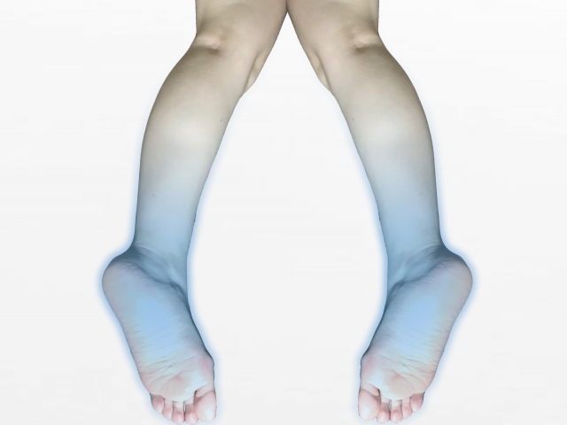 【新松戸】末端冷え性は筋肉の働きが重要｜整体と鍼灸で巡りを整える方法